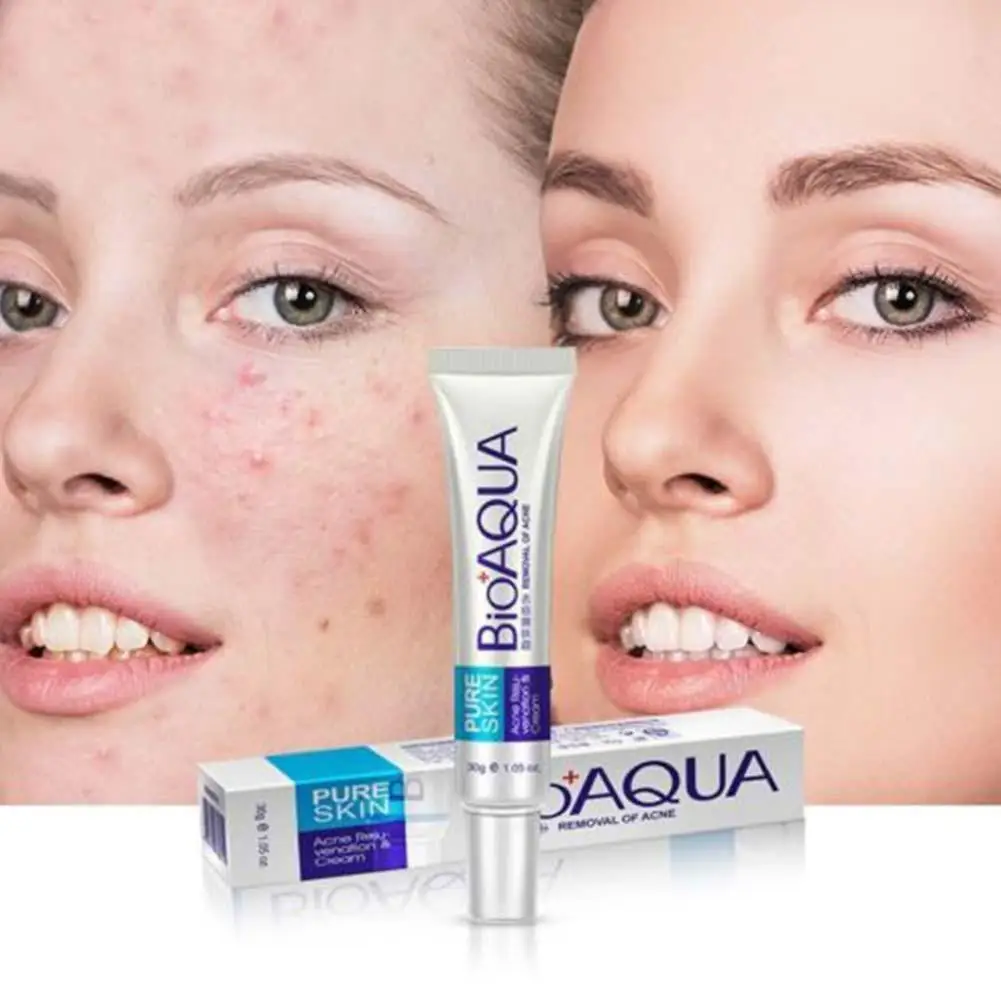 

New Bioaqua 30g Anti Acne Cream Oil Control Shrink Care Acnes Scar Oil Remover Pore Control Face Shrinkage Pore Remove Acne L6T3