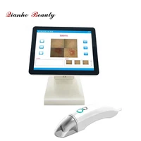 touch screen uv skin scanner analyzer