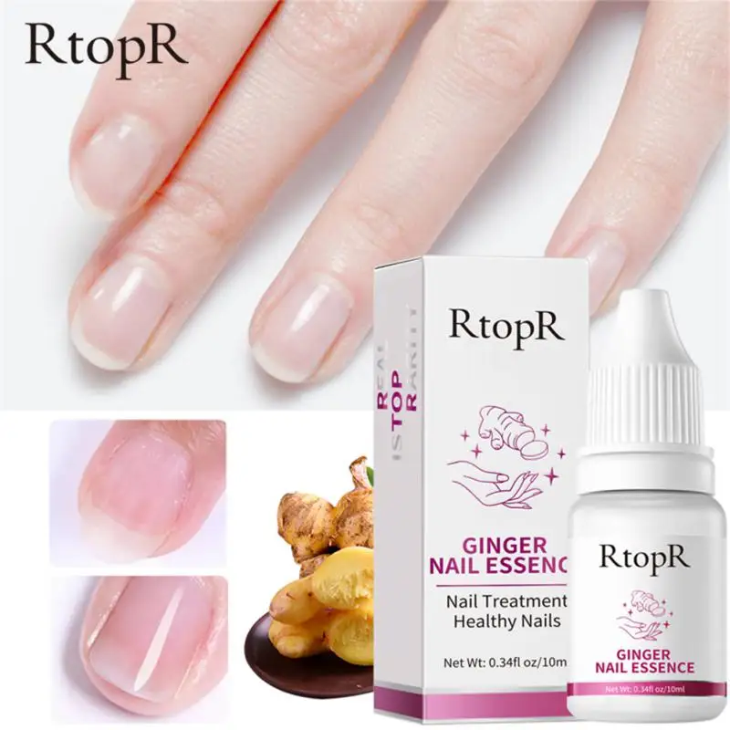 

2/3/5PCS Fungal Nail Oil Anti Nail Repair Feet Care Onychomycosis Removal Gel Liquid Antifungal Nail