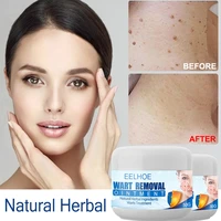 50g body wart remover cream natura natural herbal skin care tag warts treatment foot corn removal cream anti moles gel beauty