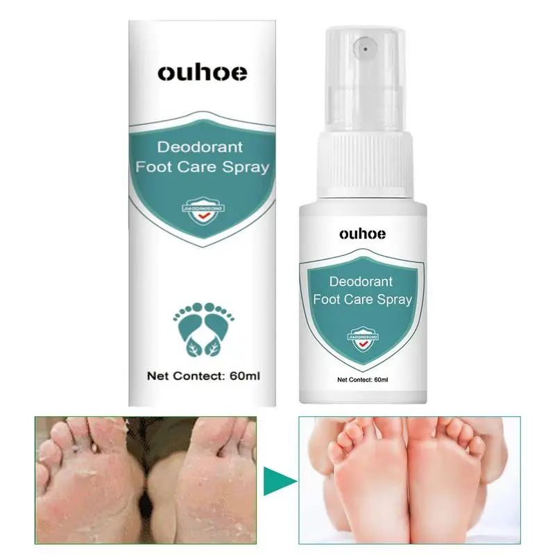 

Foot Deodorant Spray 60ml Sweat Odor Remover For Sweat Feet Natural Foot Deodorizer Foot Spray Long-Lasting Stinky Feet Care