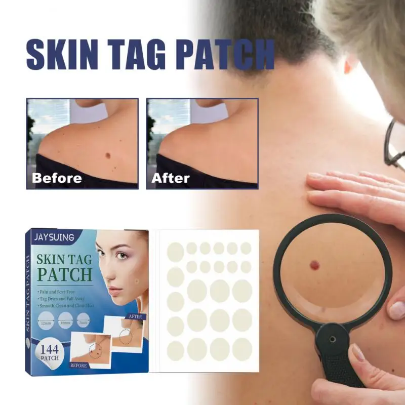 

Acne Pimple Patch Skin Tag Removal Pimple Patches Wart Remover Patch Pimple Treatments Patches Cream Acne Warts Sticker