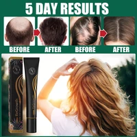 20 ml natural massage roller thickener effective fast hair growth serum oil strong hair root scalp treatments anti hair loss