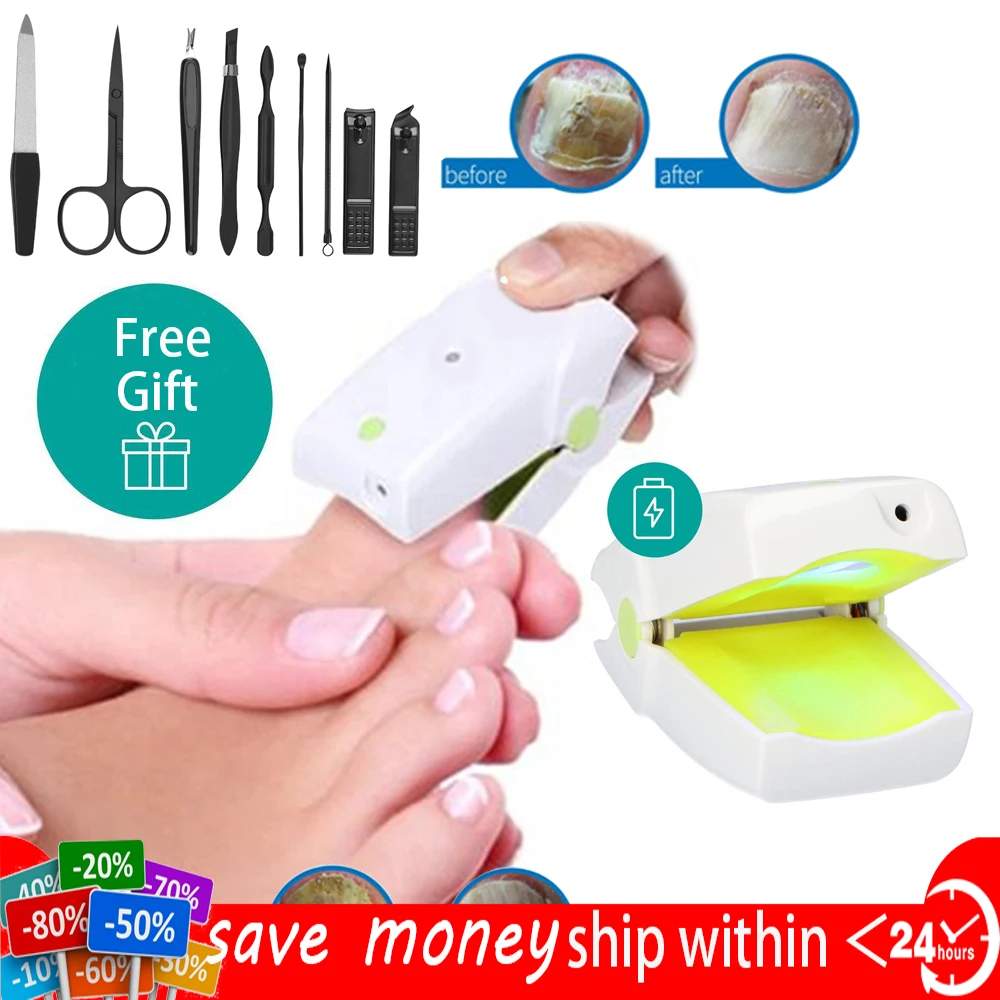 905NM painless nail fungus therapeutic instrument Laser foot care whitening nail removing fungus infection nail therapeutic inst
