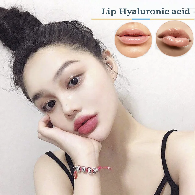 Наполнитель для губ с гиалуроновой кислотой 2 мл |