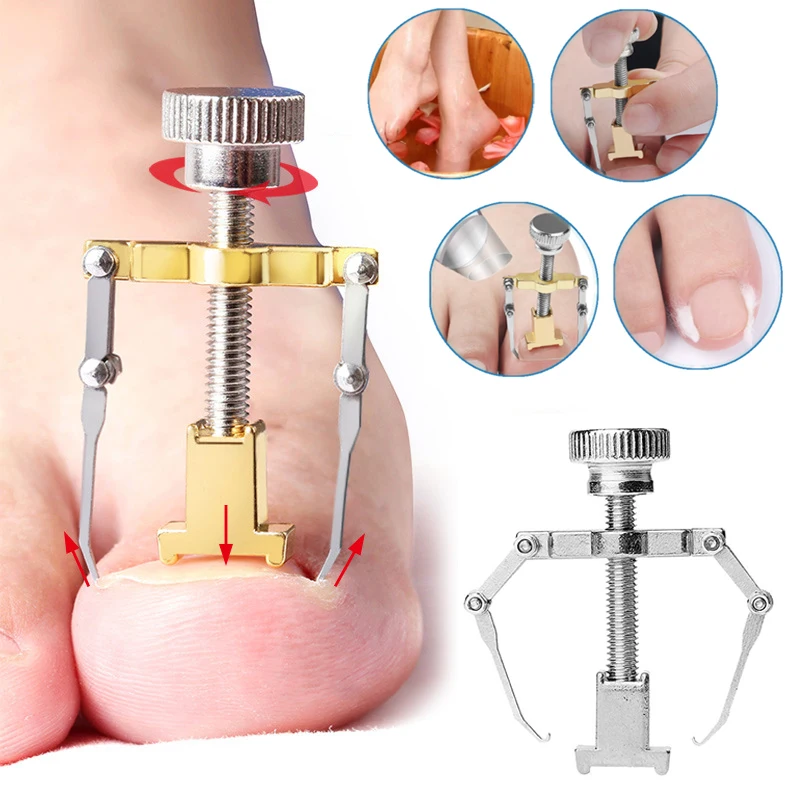 

Straightening Clip Ingrown Toenails Paronychia Cure Nail Corrector Clip Pedicure Tool Health Care Stainless Steel Relief Pain