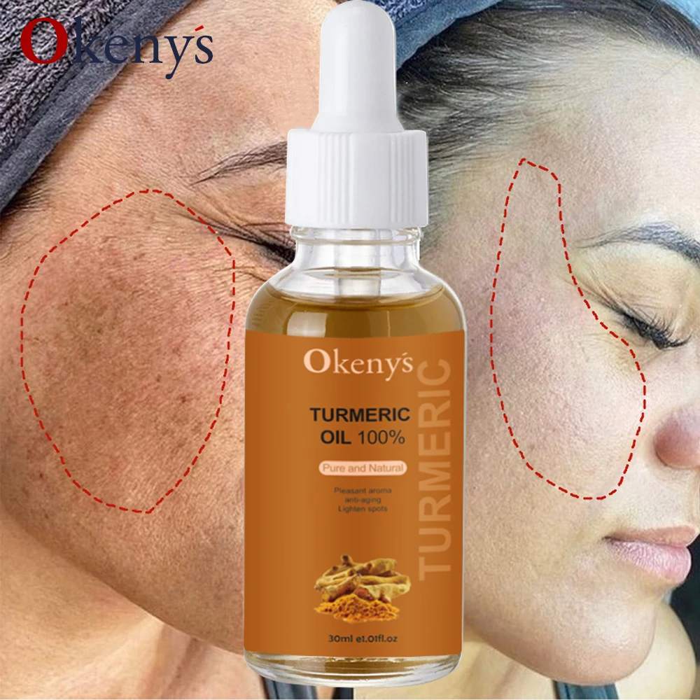 

Куркума, масло лимона, кожа, светящаяся для осветления акне, темные пятна, акне, яркая кожа, корректор темных пятен, отбеливающая Сыворотка д...