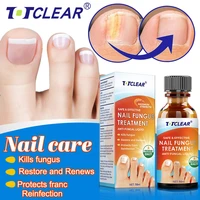 treatment fungal nail essence serum care repair foot nail fungus removal gel anti infection paronychia onychomycosis product