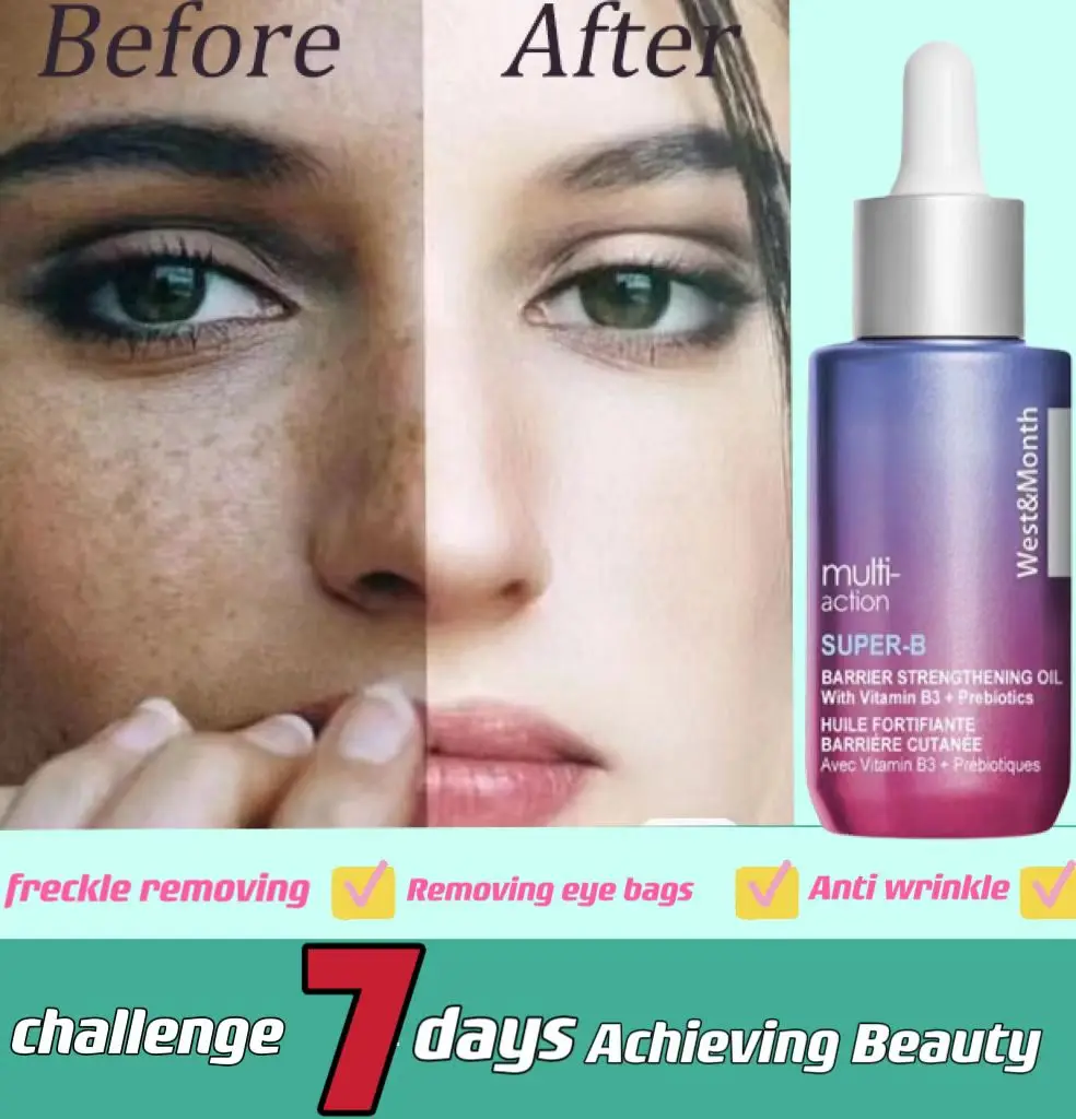 

5000 шт., пигмент для удаления черных пятен