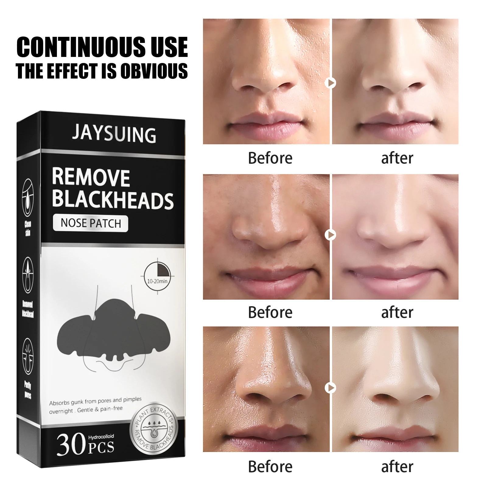 

Jaysuing Blackhead Removal Nose Sticker Peeling Type Shrink Pore Acne Treatment Removal Black Dots Deep Cleansing Skin Care