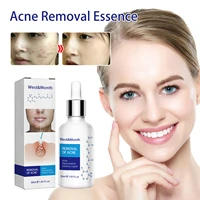acne treatment face repair essence anti acne pimple scar serum skin care pore shrinkage gentle moisturizing repairing liquid