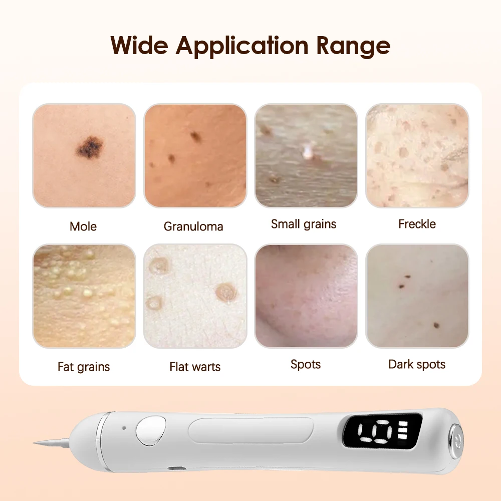 Ручка для удаления веснушек и бородавок с ЖК-дисплеем 9 скоростей