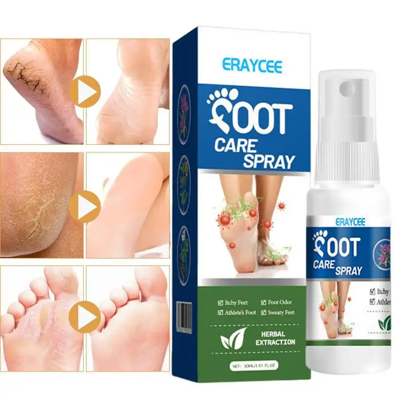 

Foot And Shoe Deodorizer Spray 30ml Odor Eliminators Liquid Deodorants Freshener Eliminate Foot Odor For Athletes Professionals