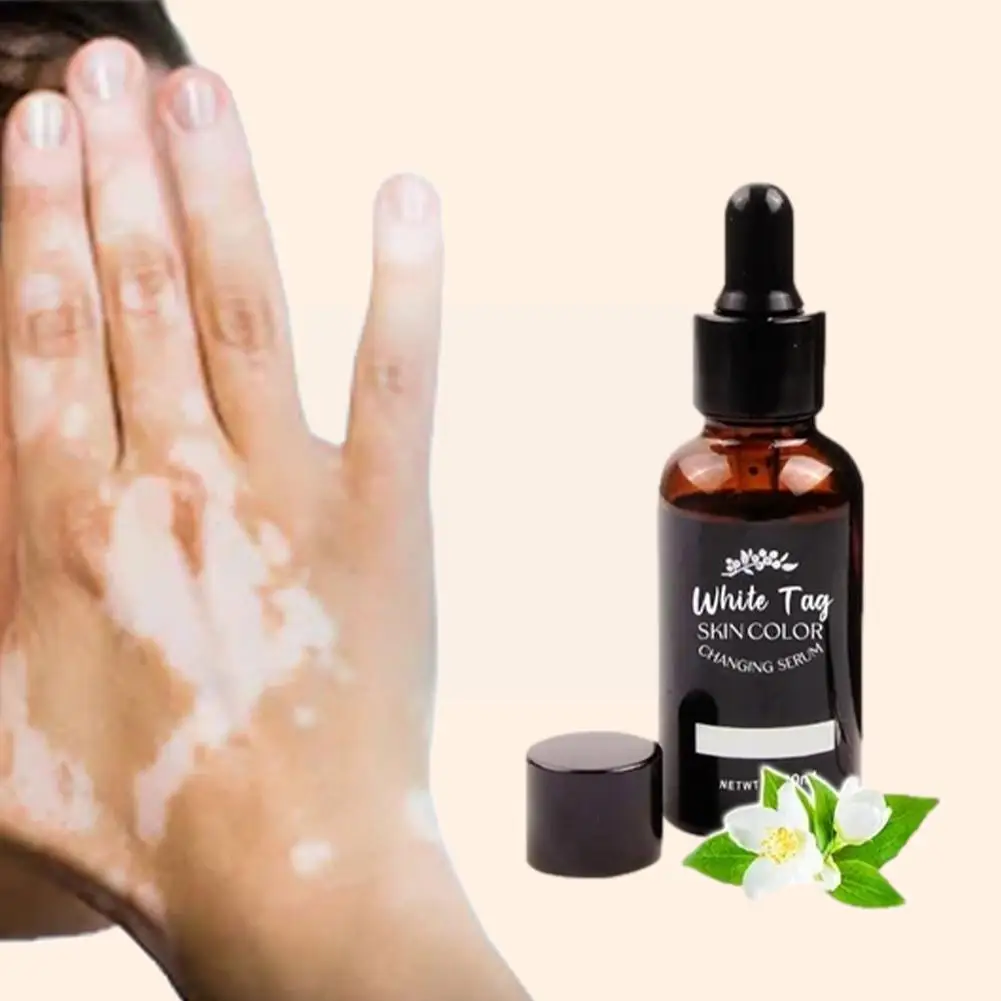 

Эссенция меланина deigmented Vitiligo для ухода за кожей 30 мл H8t8
