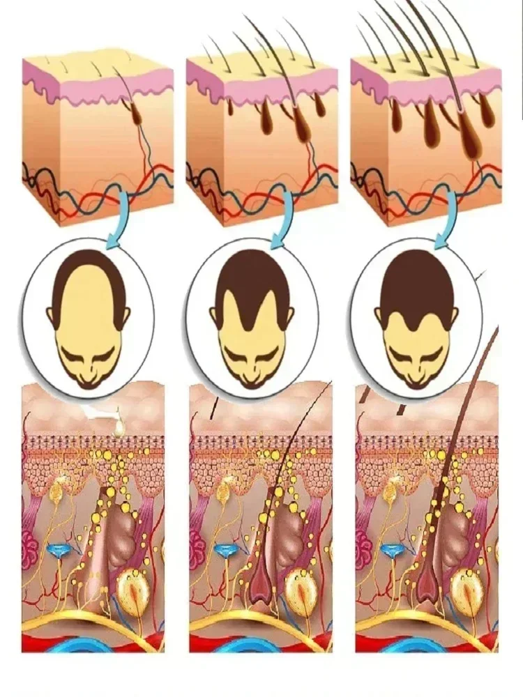 Имбирное натуральное масло для массажа волос уход за волосами выпадение