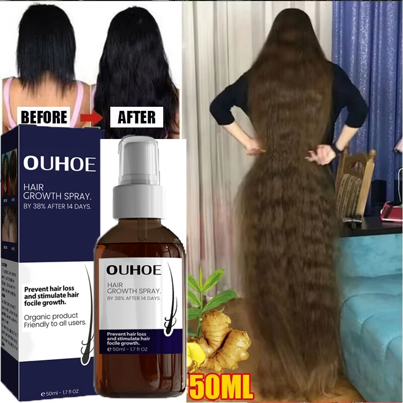 

Ginger Hair Growth Products Fast Growing Hair Spray Prevent Hair Loss Oil Scalp Treatment Dry Damaged Hair Care For Men Women