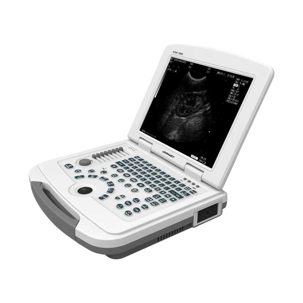 

Thin And Light Notebook Design Laptop Ultrasonic Scanner
