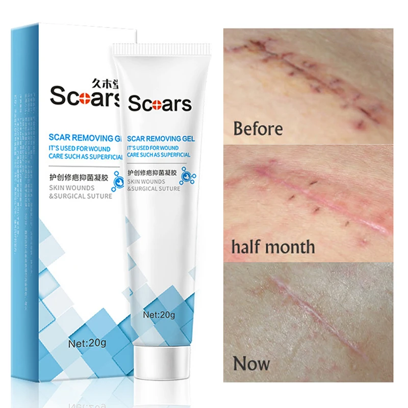 

Herbal Scar Removal Cream Gel Repairing Stretch Marks Burn Surgical Scar Remove Cesarean Acne Scar Treatment Smooth Skin Care