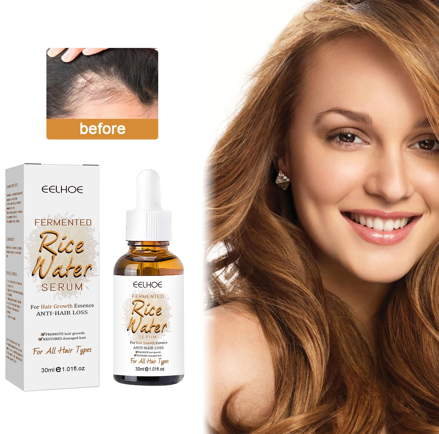 

Eelhoe fermented rice essence hair conditioner hair follicle rice moisturizing essence hair growth liquid hair care