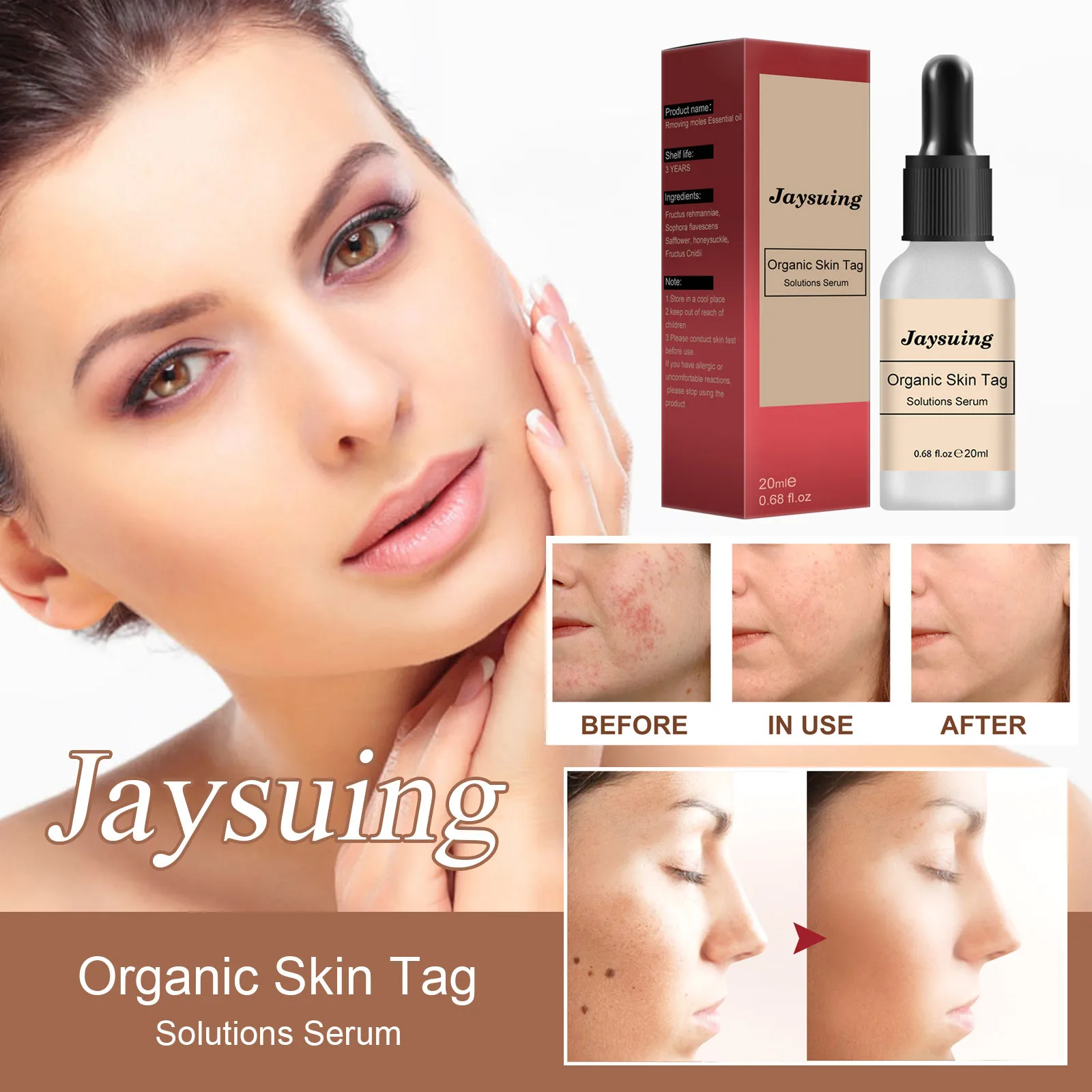 

Cleaning and Nursing of Nevus Liquid Xiaonevus Ointment To Remove Nevus Black Spots Nevus and Wart Skin and Flesh Nevus