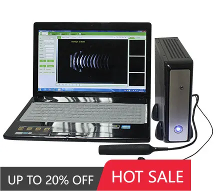 

Ophthalmic A/B Scanner Ultrasound SAB-200 A/B Scan
