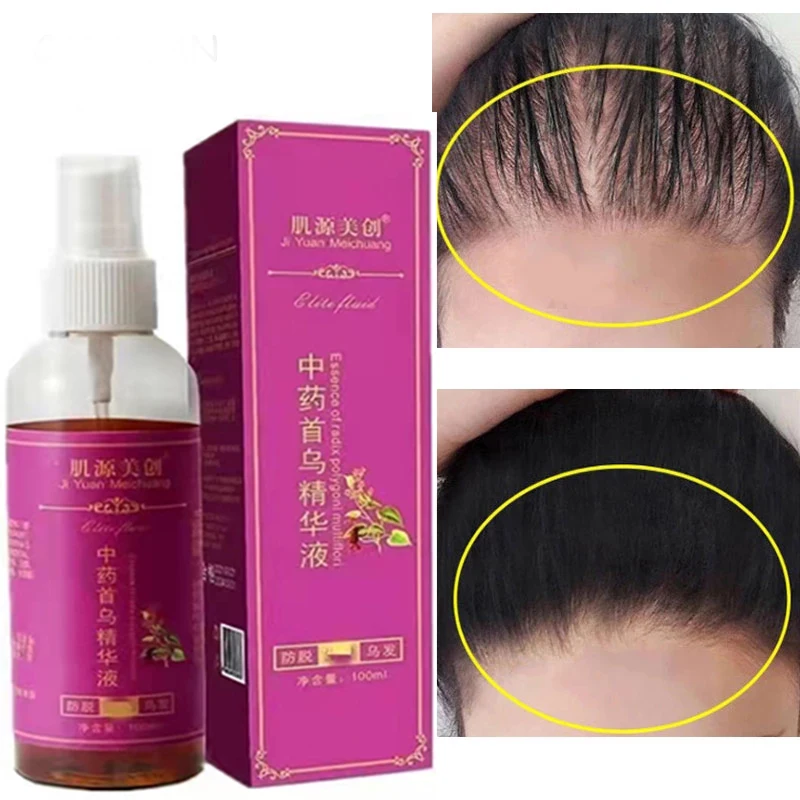 100ml Polygonum Multiflorum Herbal Hair Growth Essence Anti-hair Loss Solid Hair Growth Liquid Thick Hair Growth Repair Liquid