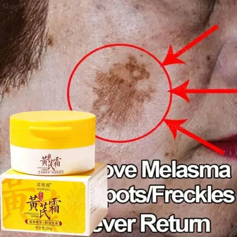 50 г отбеливающий крем для лица с экстрактом астрагала и темными пятнами