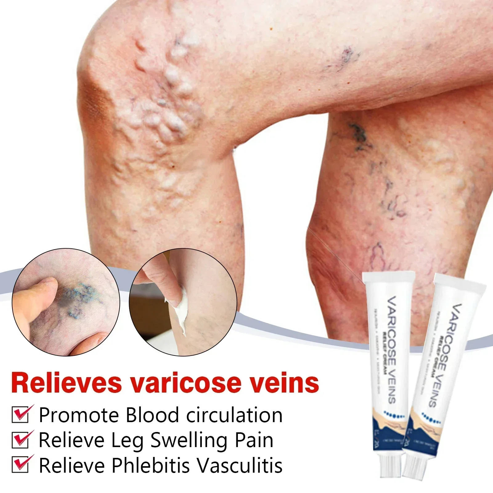 Крем от варикозного расширения вен Earthworm-Успокаивающий массажный бальзам для