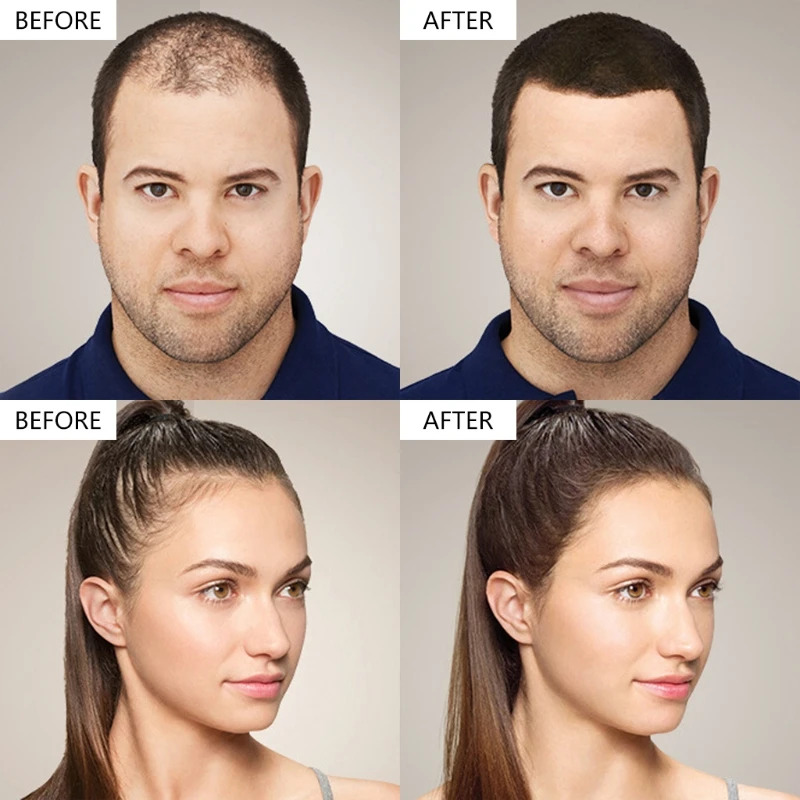 Насос для волос аппликатор распылитель насадка-распылитель сменные аксессуары