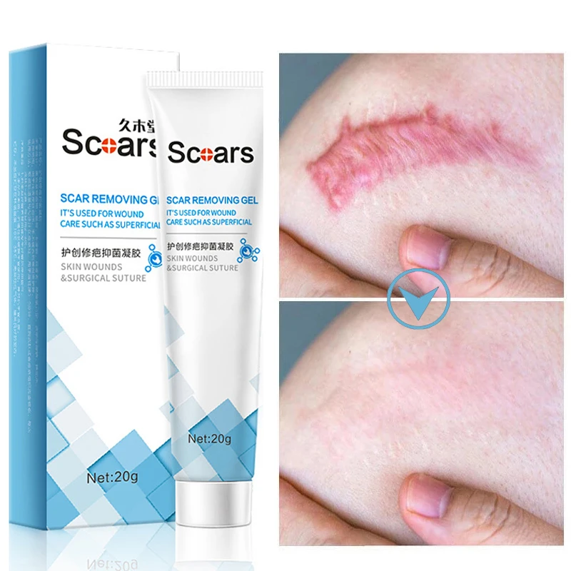 

Herbal Scar Removal Cream Gel Repairing Pock Mark Burn Surgical Scar Cesarean Scar Stretch Marks Smooth Moisturizing Skin Care