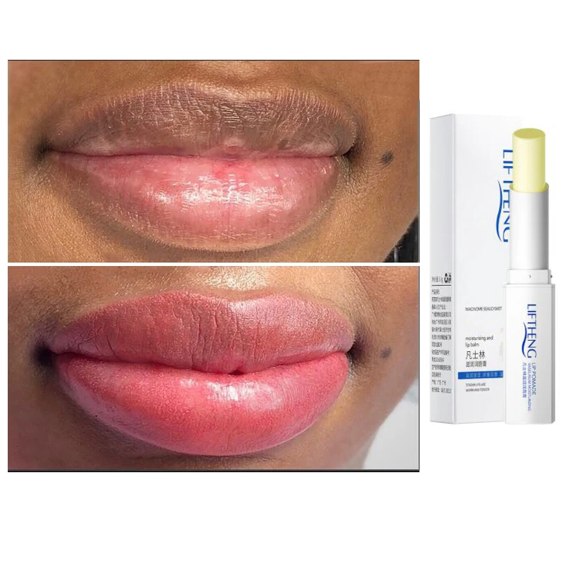 

Lip Balm Moisturizer Effective Removal Lip Black Lighten Dark Lip Melanin Moisturizer Scrub Lip Care free shipping