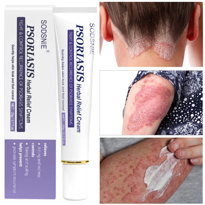 

Herbal Treatment Psoriasis Cream Anti-Fungal Ointment Anti-itch Relief Eczema Urticaria Antibacterial Repair Gel Body Skin Care