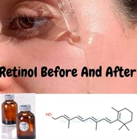 retinol 3 clinical strength organic hyaluronic acid potent wrinkle serum anti aging plumps wrinkles fine lines brightening