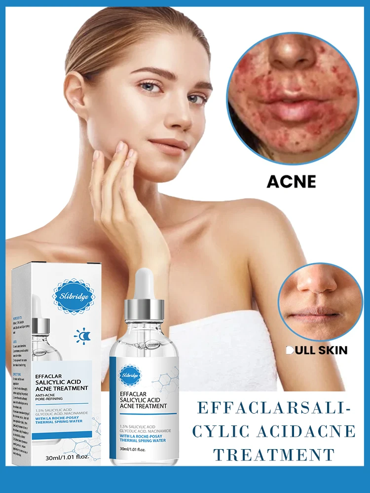 Отбеливающий крем для удаления акне эффективное средство ухода за кожей