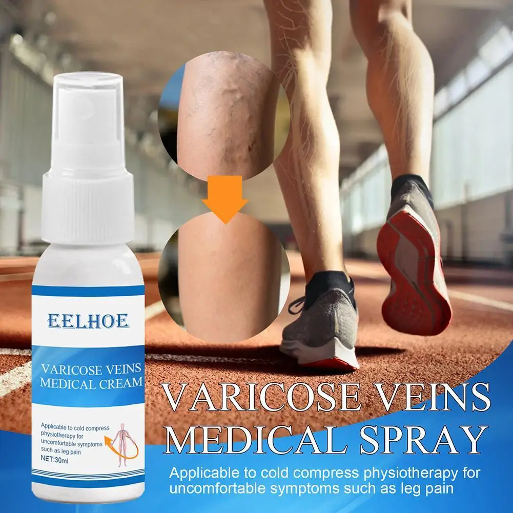 

30g Varicose Vein Soothing Spray Veins Treatment Spray On Leg Acid Bilges Itching Earthworm Lumps Bad Leg Cure Natural Solution