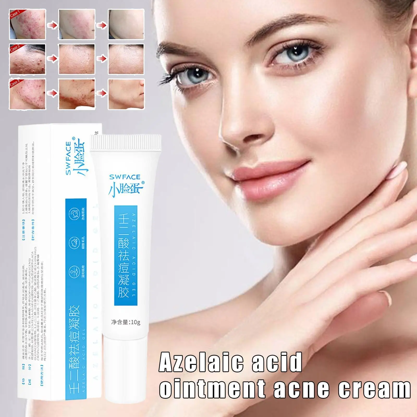 

Effective Acne Removal Cream Herbal Acne Spots Oil Control Acne Scar Cream Removal Whitening Moisturizing Face Gel Skin Care