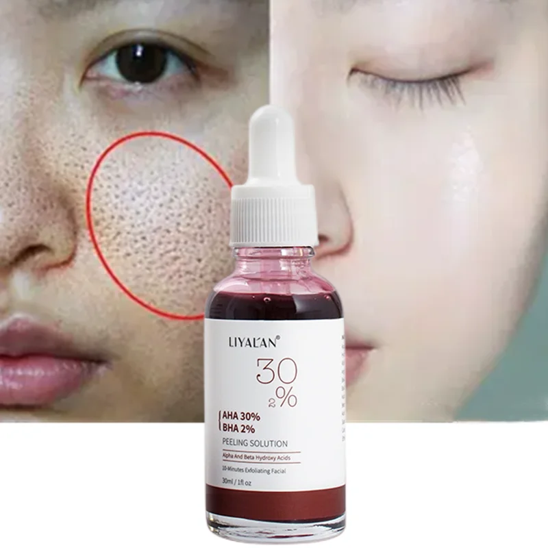 

Fruit Acid Shrink Pores Serum Exfoliating Moisturizing Smooth Pores Acne Treatmen Remove Blackhead Salicylic Acid Repair Esence