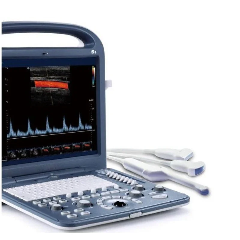 Портативный ультразвуковой аппарат Color Doppler Sonoscape S2 портативный