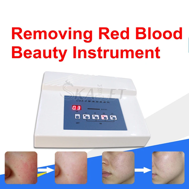 

30MHz High Frequency Portable Spider Vein Vascular Removal Machine Needle RF Anti Redness Device