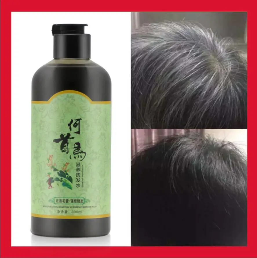 

1pcs 300ml Grey Hair Removal Anti White Hair Shampoo Treatment of Black Brunette Moisturizing Nourishing Hair Blacken Shampoo