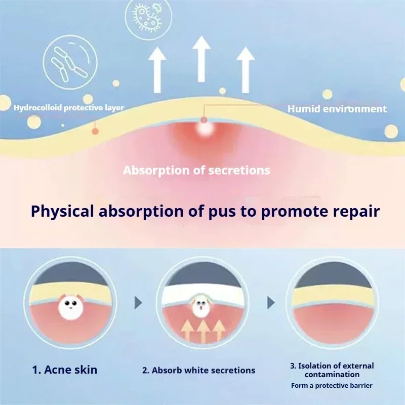 360 шт. невидимые пластыри от прыщей гидроколлоидные консилер ремонтная наклейка