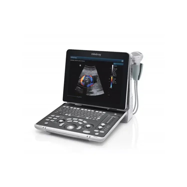 Медицинское ультразвуковое устройство Mindray портативный цветной допплер
