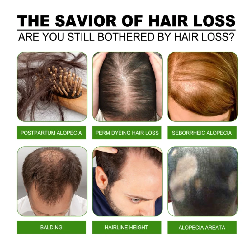 Устройство для массажа кожи головы