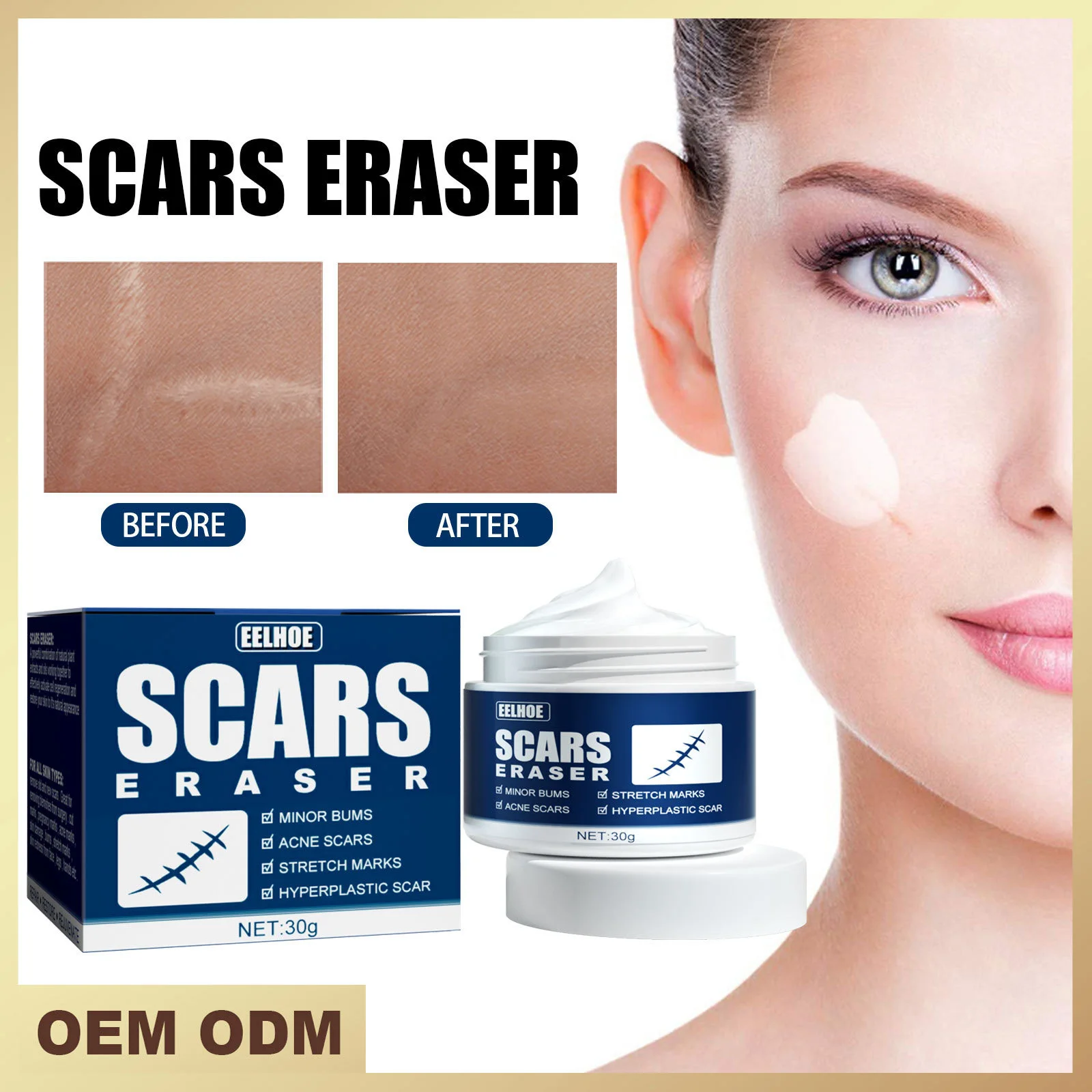 

30g Removal Scar Cream Acne Surgical Stretch Marks Pimples Face Gel Child Acne Smoothening Whitening Body Skin Care Pigmentation