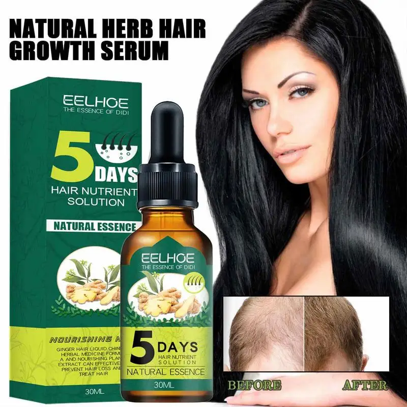 

Sdotter Ginger Hair Growth Serum Hair Loss Spray 5 Days Effective Germinal Hair Growth Essential Oil Men Women Hair Care 30ml