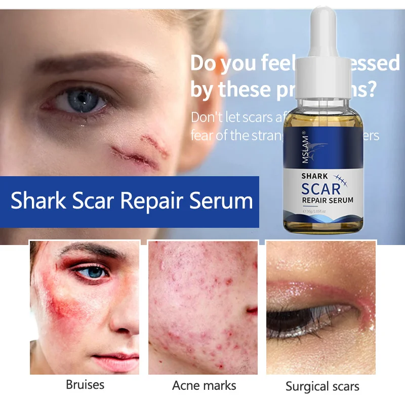 Acne Scar Removal Cream Treatment Acne Stretch Marks Pimples Spots Repair Gel Whitening Moisturizing Smoothing Body Skin Care