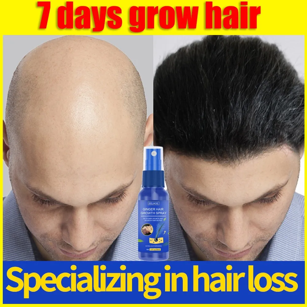 10PCS Ginger Hair Growth Spray Effective Treatment for Baldness Hereditary Hair Loss Postpartum Hair Loss Seborrheic Hair Loss