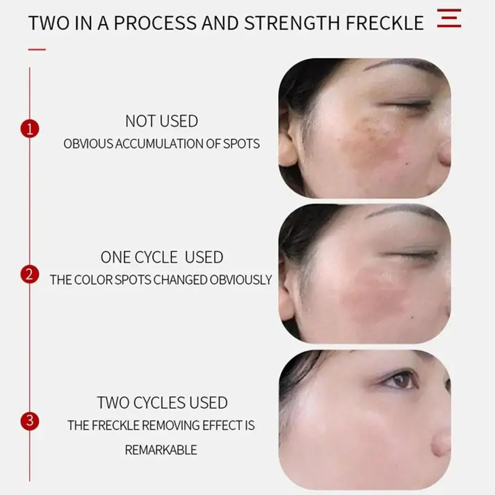 Рисунок 5 - Средство для удаления черных точек