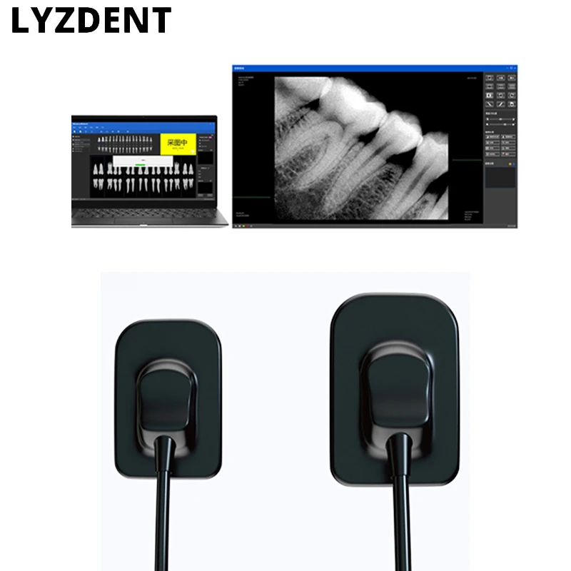 Материал стоматология стоматологический датчик рентгеновский высокочастотный