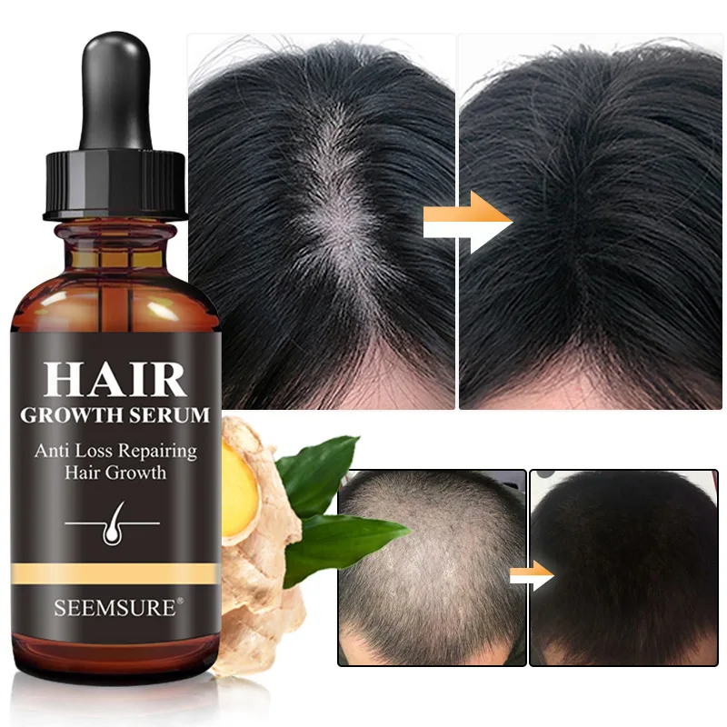

Hair Growth Essential Oil Hair Regrowth Serum Hair Thinning Treatment Fast Hair Grow Liquid Anti-Hair Loss for Women & Men